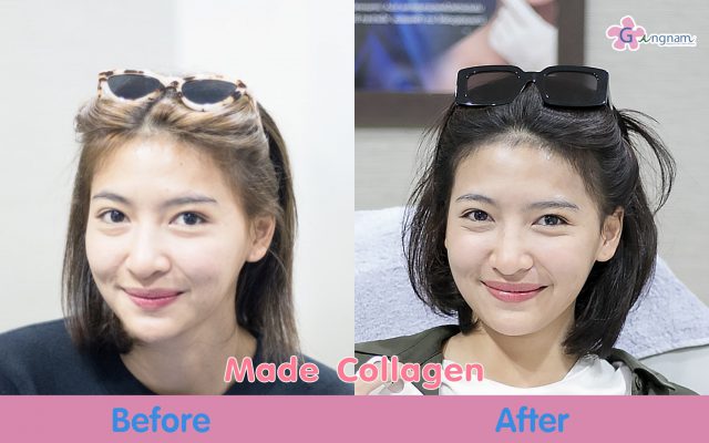 made collagen มาเด้