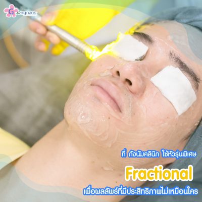 Dual Yellow laser เลเซอร์หน้าใส