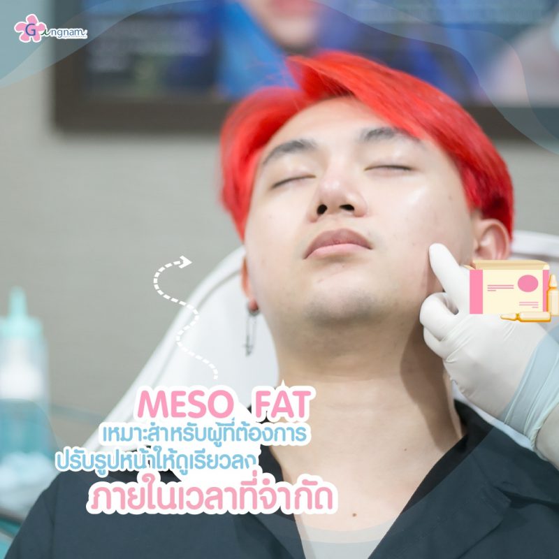 MESO FAT เมโสแฟต