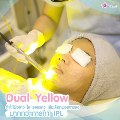 Dualyellow เลเซอร์