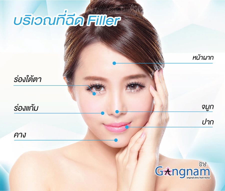 ฉีดฟิลเลอร์-บริเวณต่างๆ