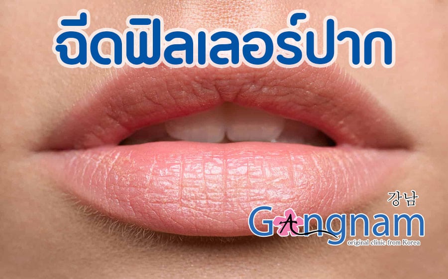 ฉีดฟิลเลอร์ปาก