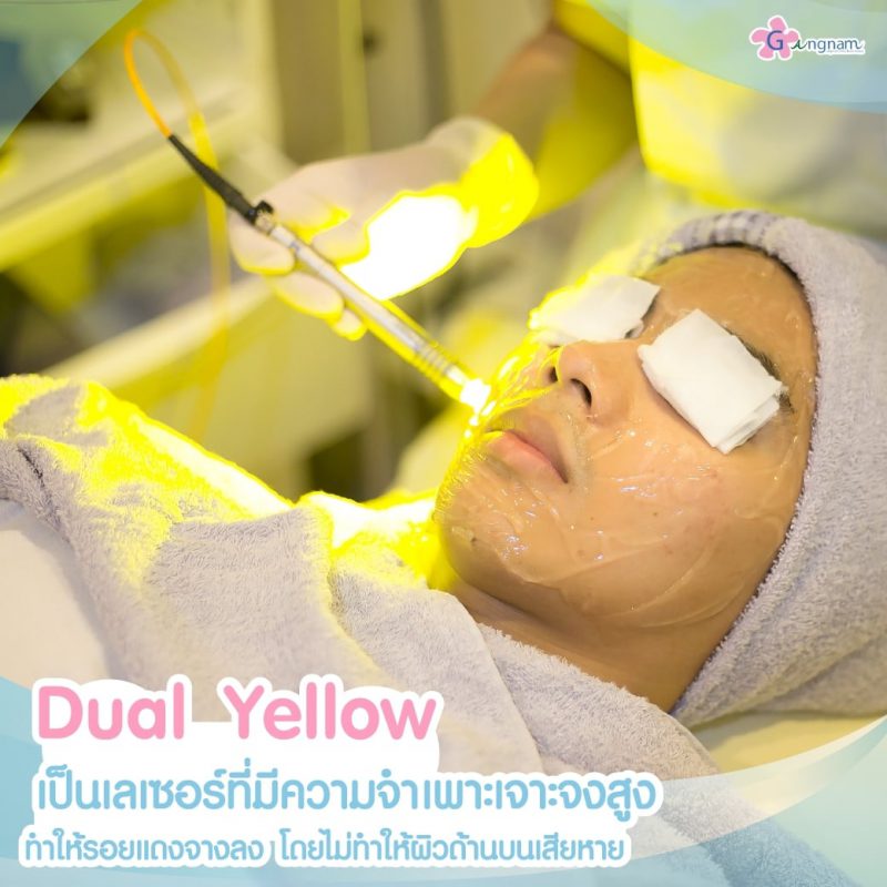 Dual Yellow เลเซอร์หน้า