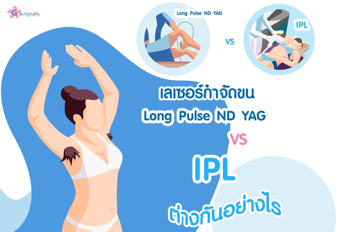 เลเซอร์ขนรักแร้ long pulse nd yag