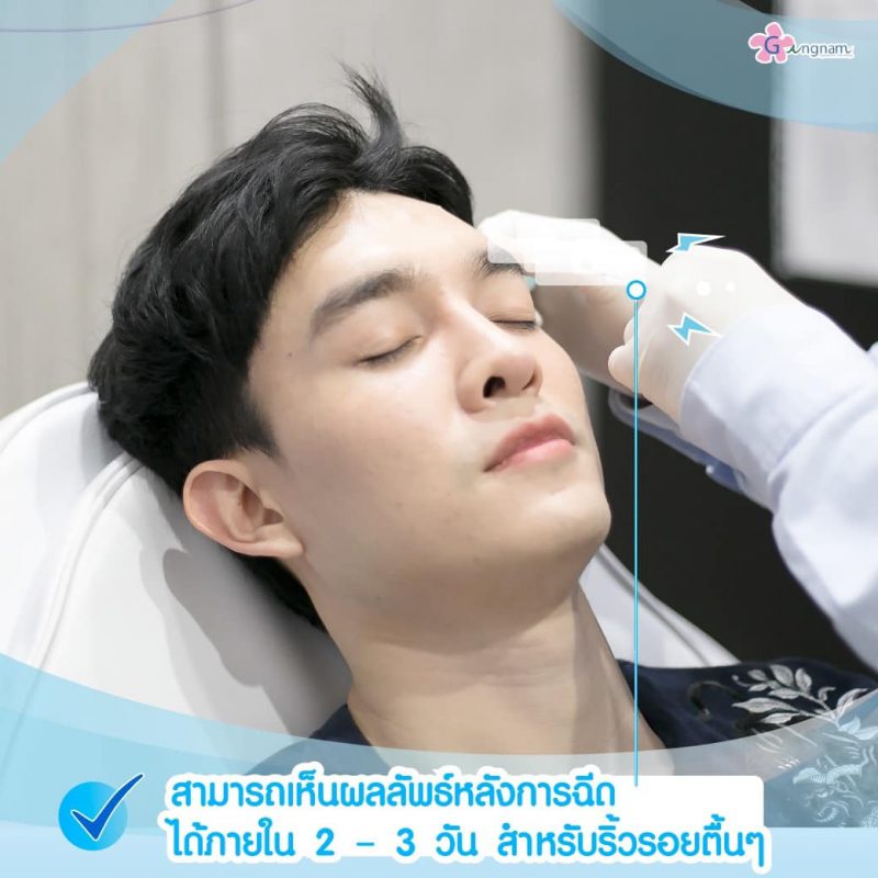 ผลลัพธ์ฉีดโบท็อก